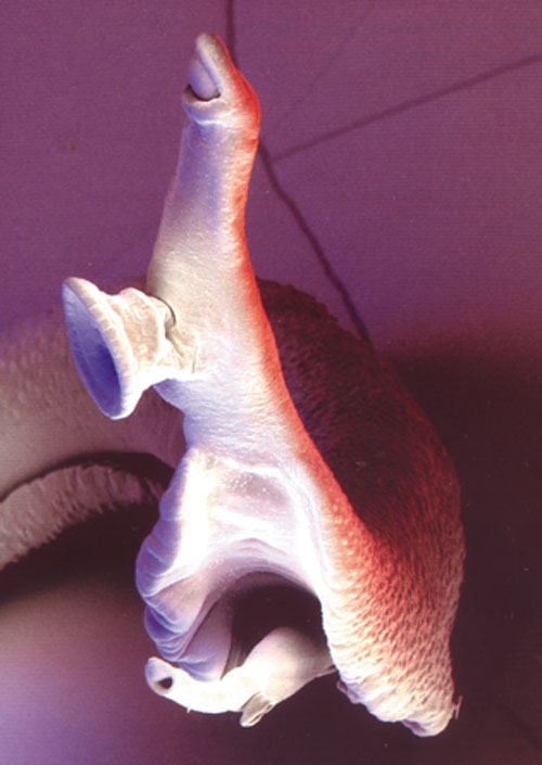 SCARY SCHISTOSOMES Worms 