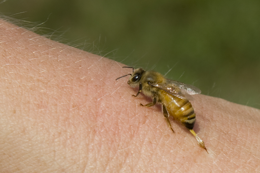 Report: More People Killed By Bees, Drowning In Bath Than From Terrorism Photo Report: More People Killed By Bees, Drowning In Bath Than From Terrorism bee sting 2