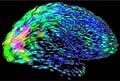 brain